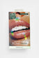 Classic Diamond DIY Tooth Gem Kit